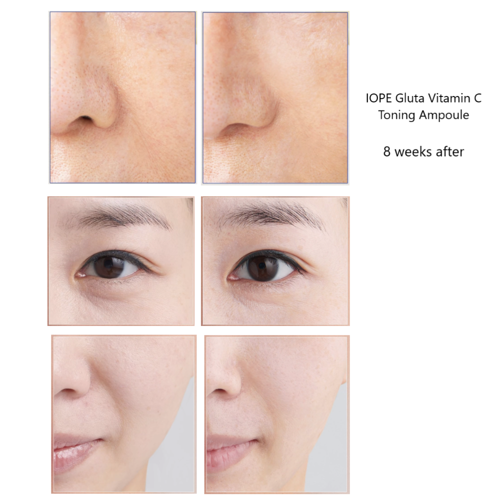 IOPE Gluta Vitamin C before & after 8 weeks | K-Beauty Blossom USA