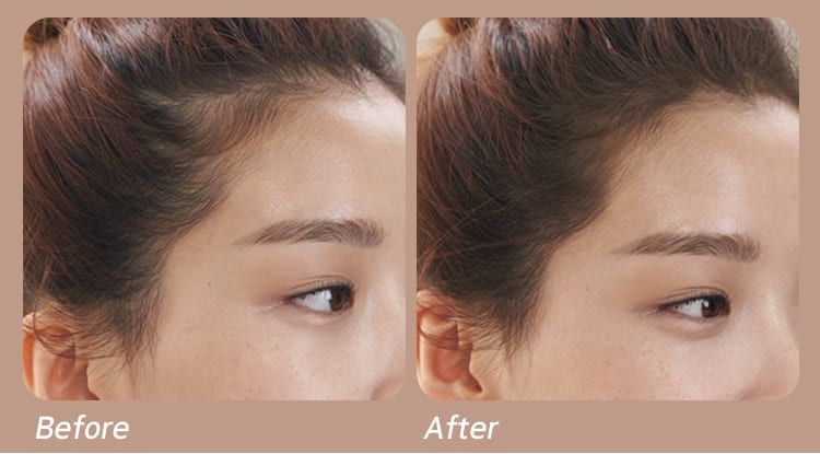 before and after using mamonde pangpang hair shadow